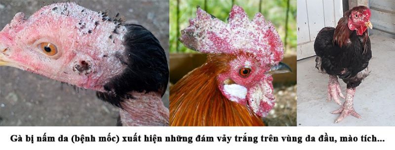 Bôi thuốc tây ngoài da cũng đẩy lùi được mốc